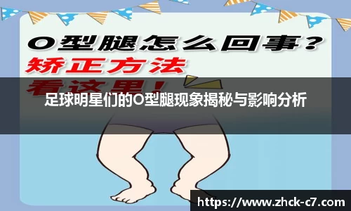 足球明星们的O型腿现象揭秘与影响分析